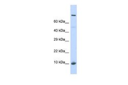NSUN5B Rabbit anti-Human, Polyclonal, Novus Biologicals 100 &mu;g | Buy Online | Novus Biologicals | Fisher Scientific